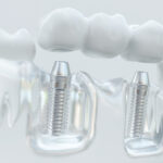 Cosmetic Dentistry