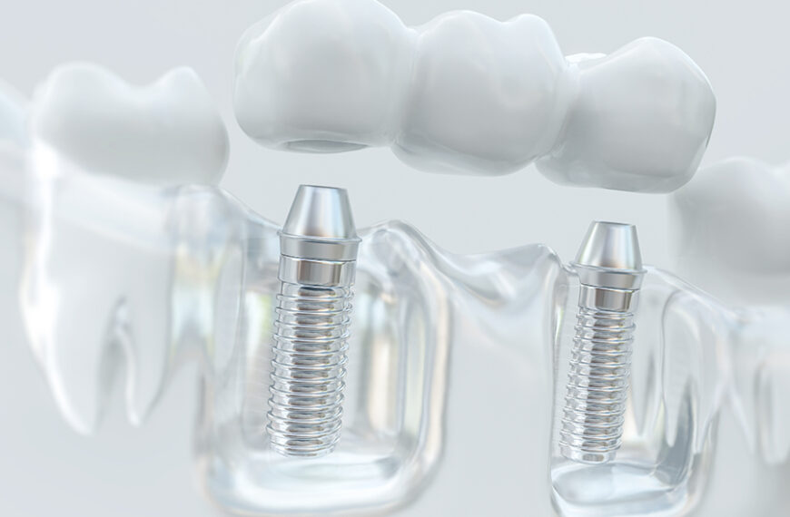 Clearview Dental