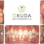 Okuda Orthodontics