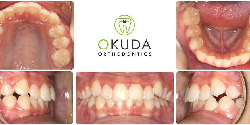 Okuda Orthodontics